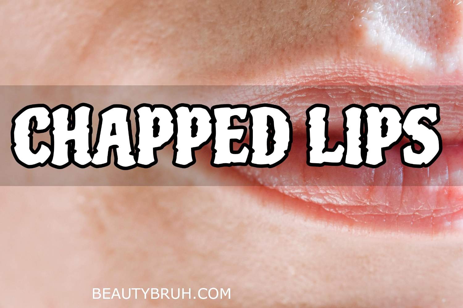 How to avoid Chapped Lips